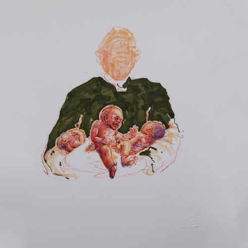 اختلال چندگانه